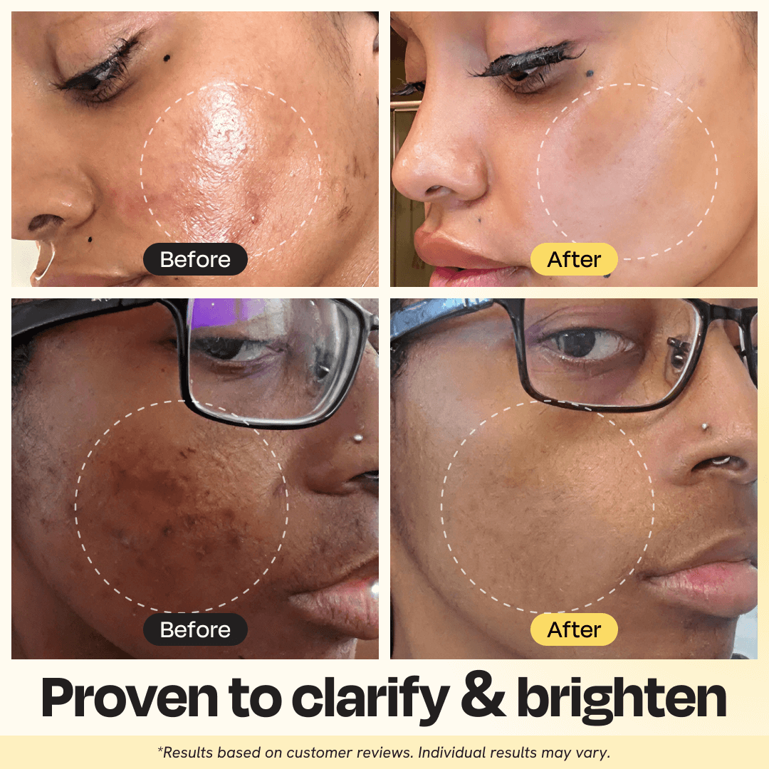 Vitamin C Clay Mask – Fade Dark Spots in 10 Minutes