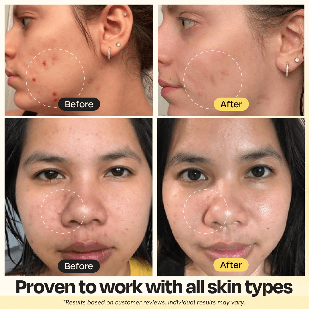 Vitamin C Clay Mask – Fade Dark Spots in 10 Minutes
