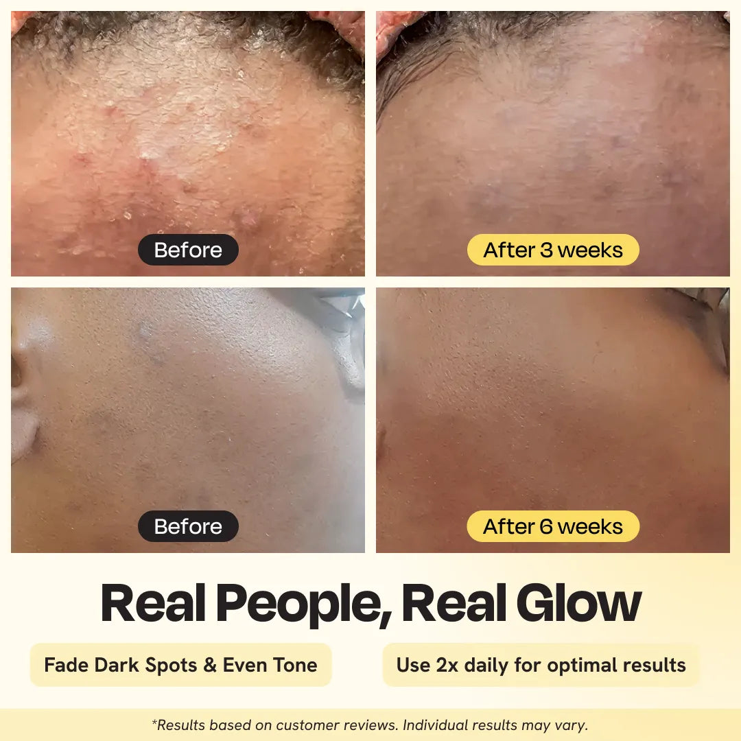 Brightening Daily Moisturizer – Hydrate, Glow & Even Skin Tone