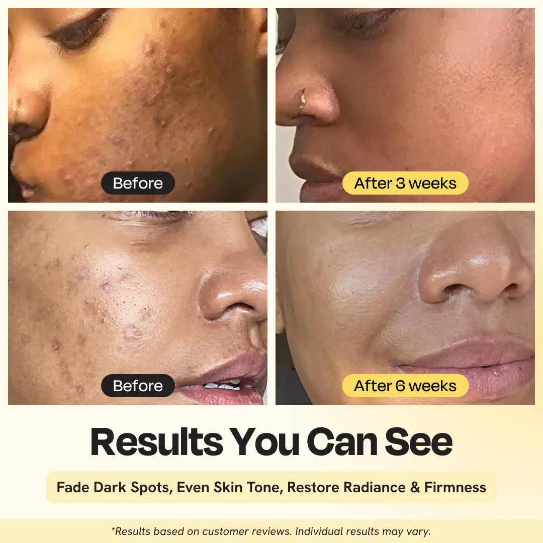 Vitamin C Brightening Serum – Fade Dark Spots & Even Skin Tone